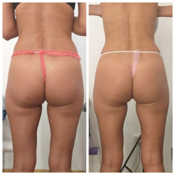 Popa Kak Orex, Павлоград Фото - 11