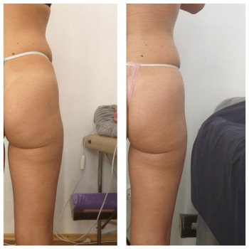 Popa Kak Orex, Павлоград Фото - 12