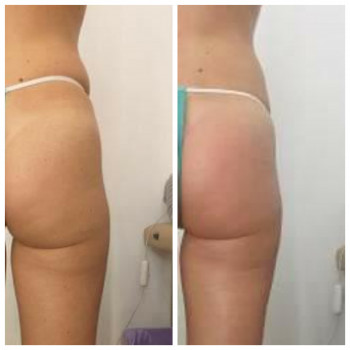 Popa Kak Orex, Павлоград Фото - 13