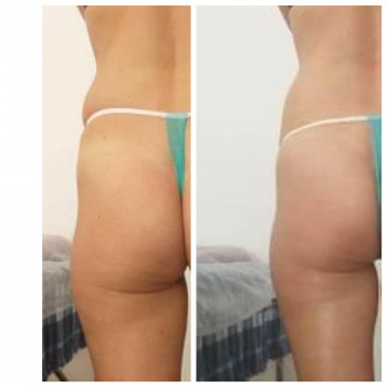 Popa Kak Orex, Павлоград Фото - 14