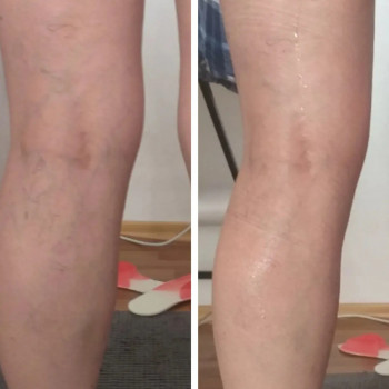 Popa Kak Orex, Павлоград Фото - 16