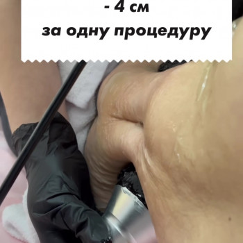 Кавитация
                    Масажний салон Popa Kak Orex Павлоград