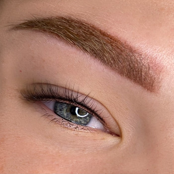 Межресничка