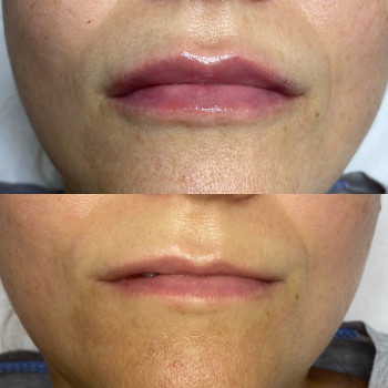 Замечательный пример того, что можно сделать аккуратно, нату