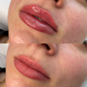 Исправление асимметрии - это реально 
Красивые, ровные, пре