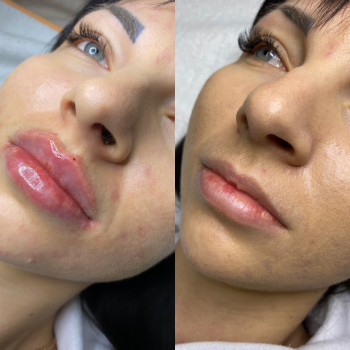 Аккуратный бантик ?