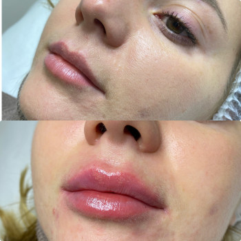 Нежно и натурально