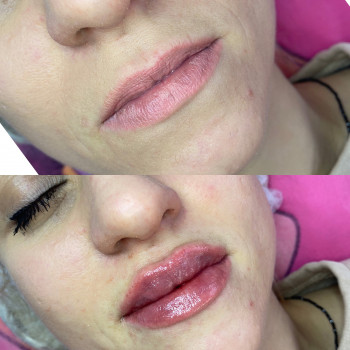 Много лишней ткани и морщинок, которые добавляют года? Больш