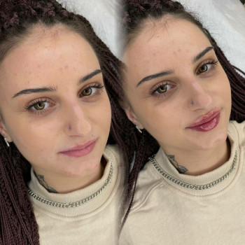 Тетяна Манастирна, Ірпінь Фото - 29