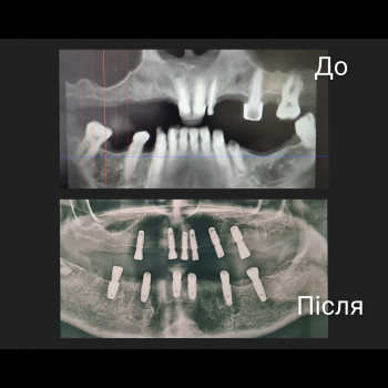 Фото з портфоліо клініки Victoria (стоматологічна клініка, Київ)