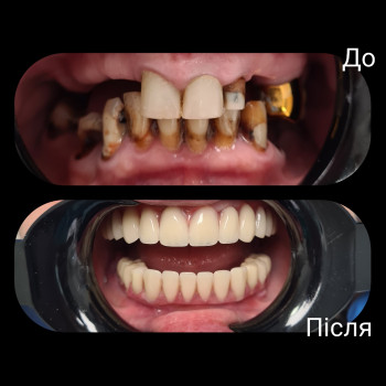 Фото з портфоліо клініки Victoria (стоматологічна клініка, Київ)