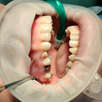 Деніель Логойда, Мукачево Фото - 3