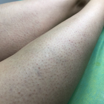 Альона Бороховська, Чернігів Фото - 7