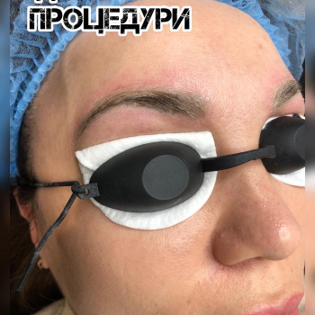 Видалення татуажу губ, брів
                    Косметолог Ирина Киев