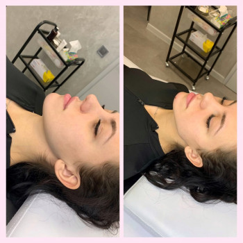 Кути Джолі, підборіддя