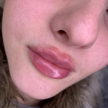 Первинні 1 мл