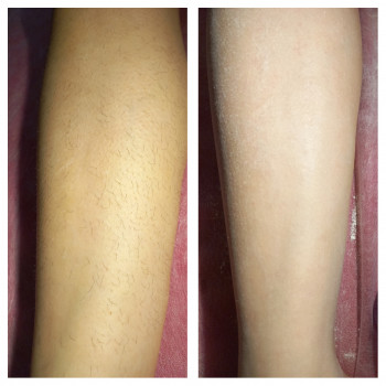 Олена Левинець, Чорноморськ Фото - 5