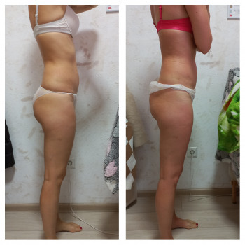 Олена Левинець, Чорноморськ Фото - 6