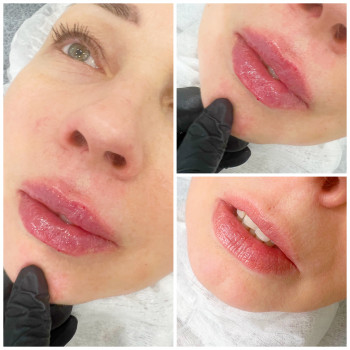 Наталья Грицай, Днепр Фото - 82