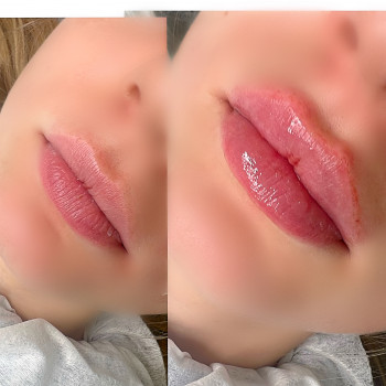 Наталья Грицай, Днепр Фото - 83