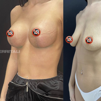 Абдель Эрритали, Харків Фото - 54