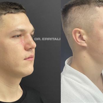 Абдель Эрритали, Харків Фото - 61