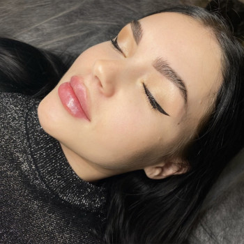 Збільшення губ