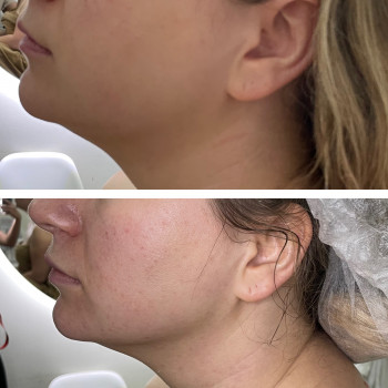 Фото из портфолио косметолога Зинаида Шуллер (Ужгород)