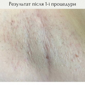 Doctor Laser, Тернополь Фото - 5