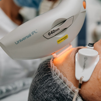 Фотоомолодження обличчя Lumenis M22 модуль IPL