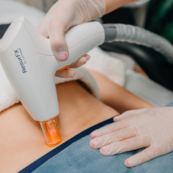 Видалення рубців Lumenis M22 модуль ResurFX