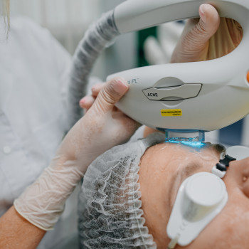 Лікування акне Lumenis M22 модуль IPL