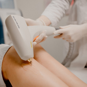 Видалення судин на ногах Lumenis M22 модуль Multi-Spot Nd-YA