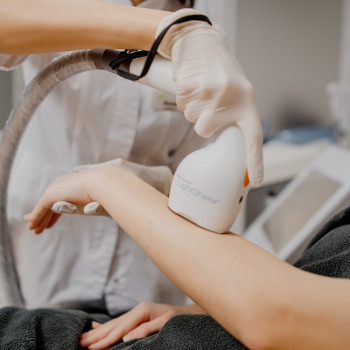 Лазерна епіляція рук