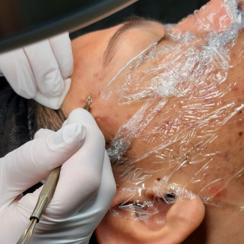 Комбінованна чистка обличчя
                    Салон красоты En Ajoure Киев