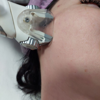 My B-flexy, Бровари Фото - 9