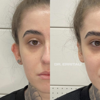 Абдель Эрритали, Київ Фото - 66