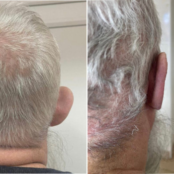 Абдель Эрритали, Київ Фото - 70