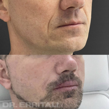 Абдель Эрритали, Київ Фото - 79