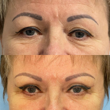 Абдель Эрритали, Київ Фото - 82