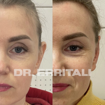 Абдель Эрритали, Київ Фото - 83