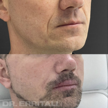 Абдель Эрритали, Київ Фото - 84