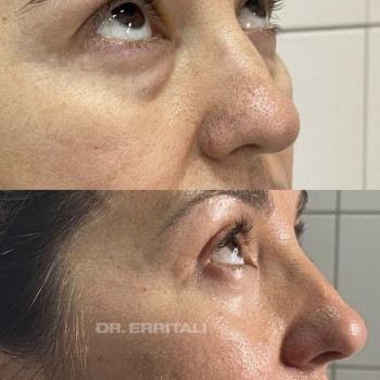 Абдель Эрритали, Київ Фото - 86