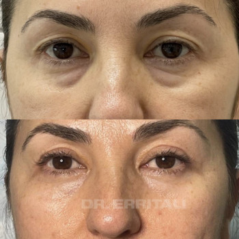 Абдель Эрритали, Київ Фото - 87