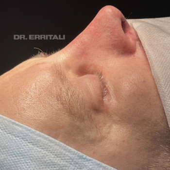 Абдель Эрритали, Київ Фото - 88