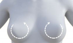 Видалення поліакриламідного гелю Медицинский центр Alpha Cell Ровно