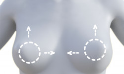 Корекція положення імплантів Медичний центр Alpha Cell Рівне