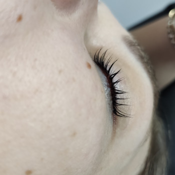 Ламі, ботокс вій