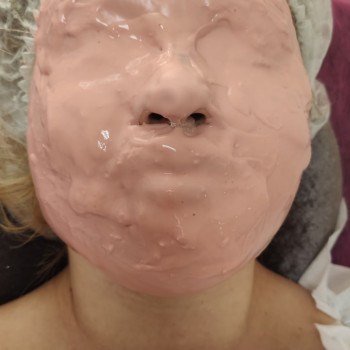 Чистка обличчя, пілінг
                    Лікар-косметолог Наталія Чернівці