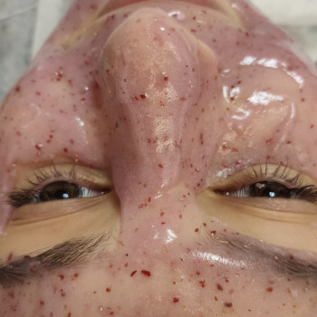 Чистка обличчя, пілінг
                    Лікар-косметолог Наталія Чернівці